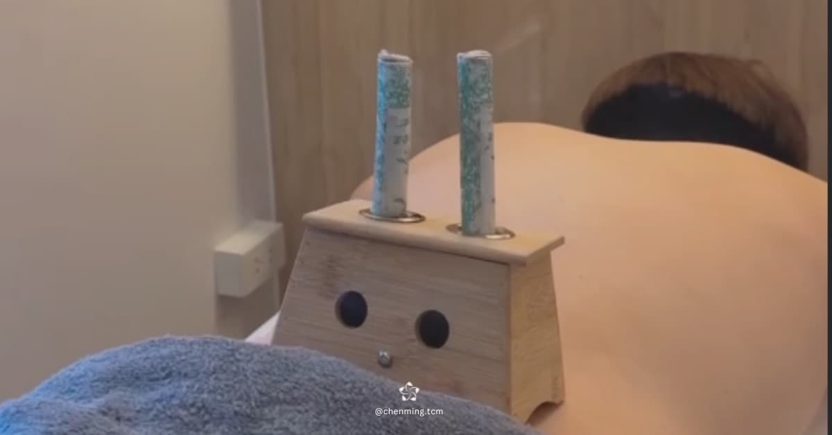 Moxibustion at Chenming TCM Clinic, Bangkok Chinatown near Hua Lamphong MRT