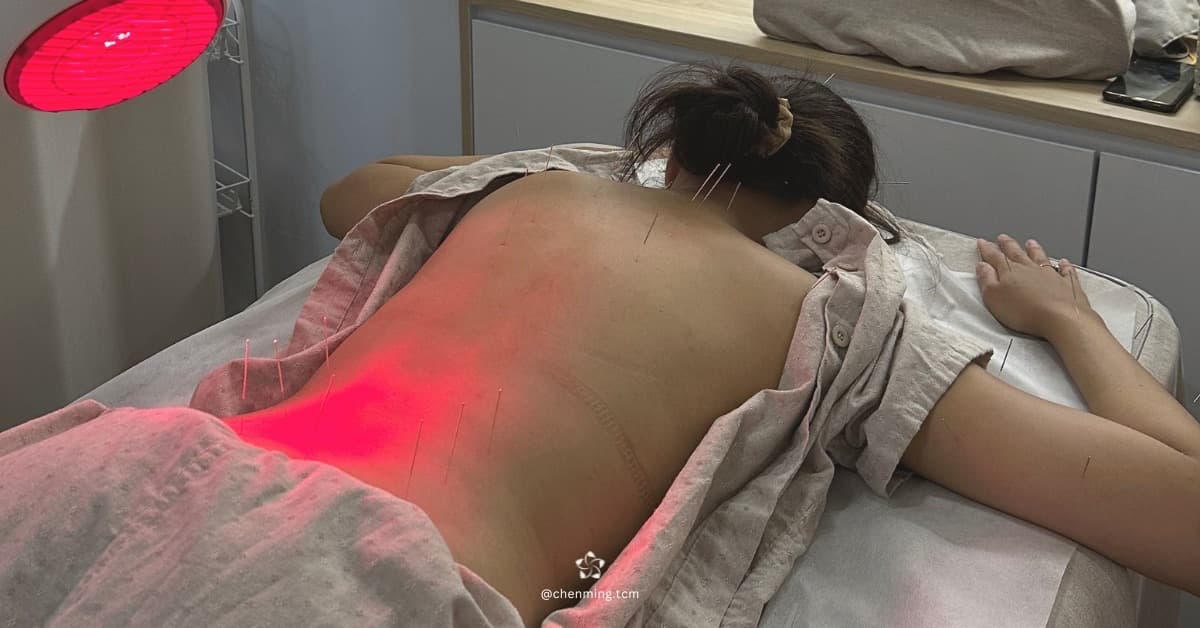 Acupuncture at Chenming TCM Clinic, Bangkok Chinatown near Hua Lamphong MRT