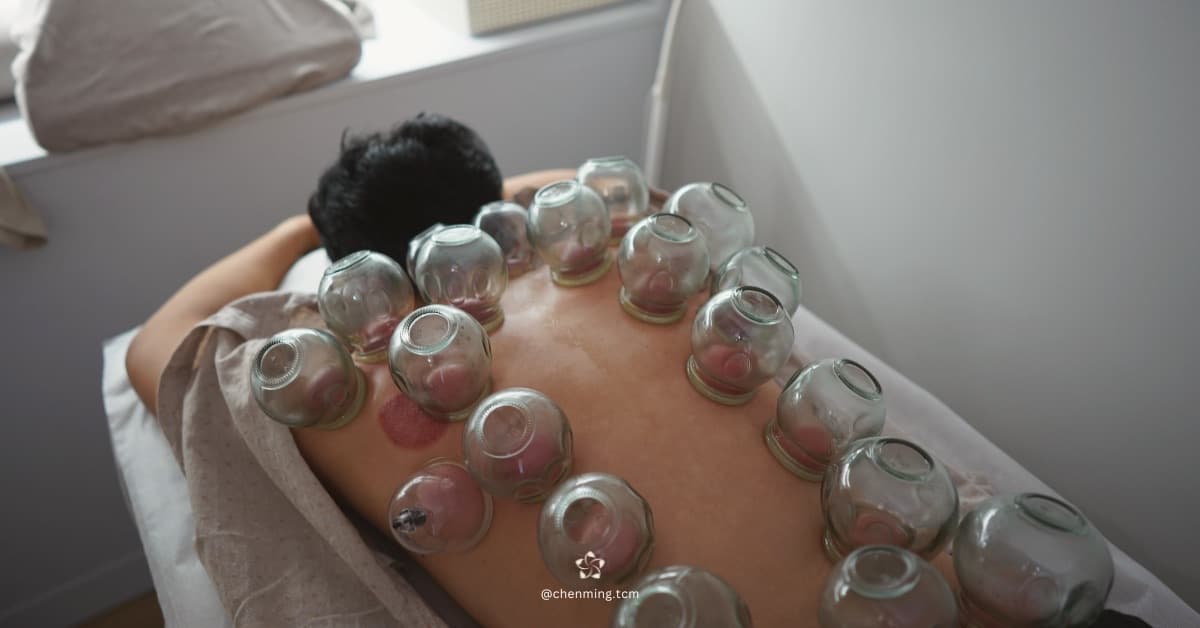 Cupping Therapy at Chenming TCM Clinic, Bangkok Chinatown near Hua Lamphong MRT